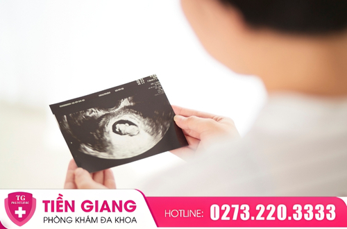 Thai dị tật là tình trạng bất thường về hình thái và sự phát triển của thai nhi.